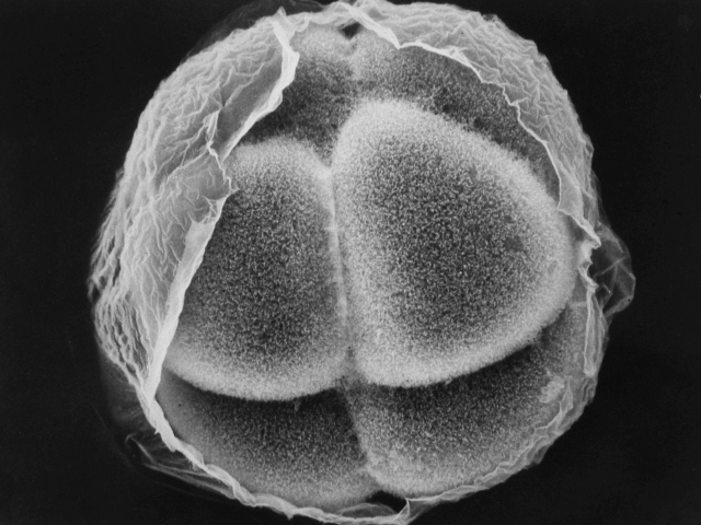 8 cell seaurchin embryo