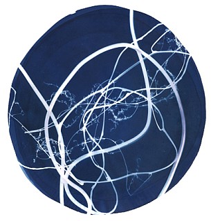 Arteriogram cyanotype